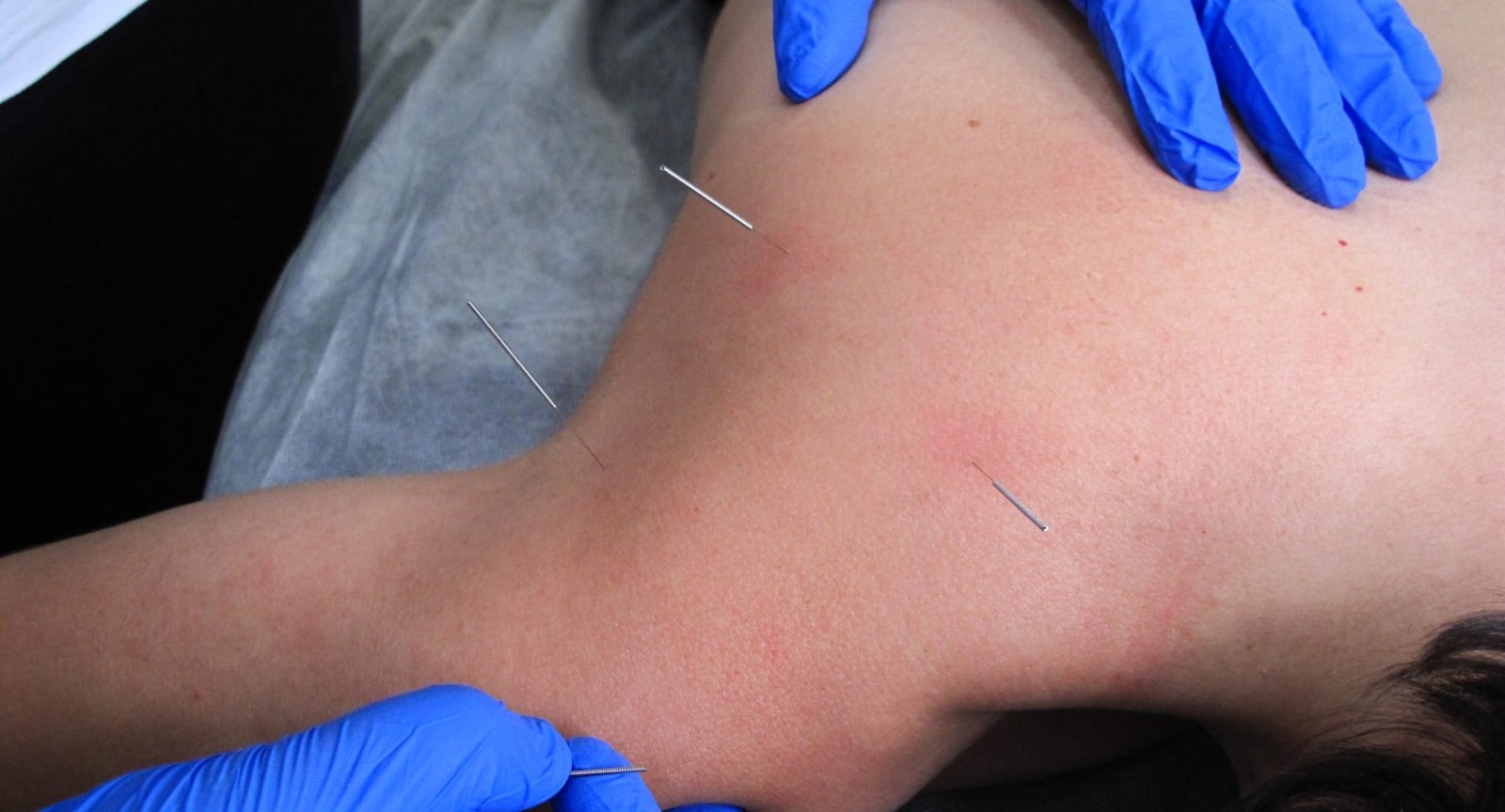 INICIO galea fisioterapia 2