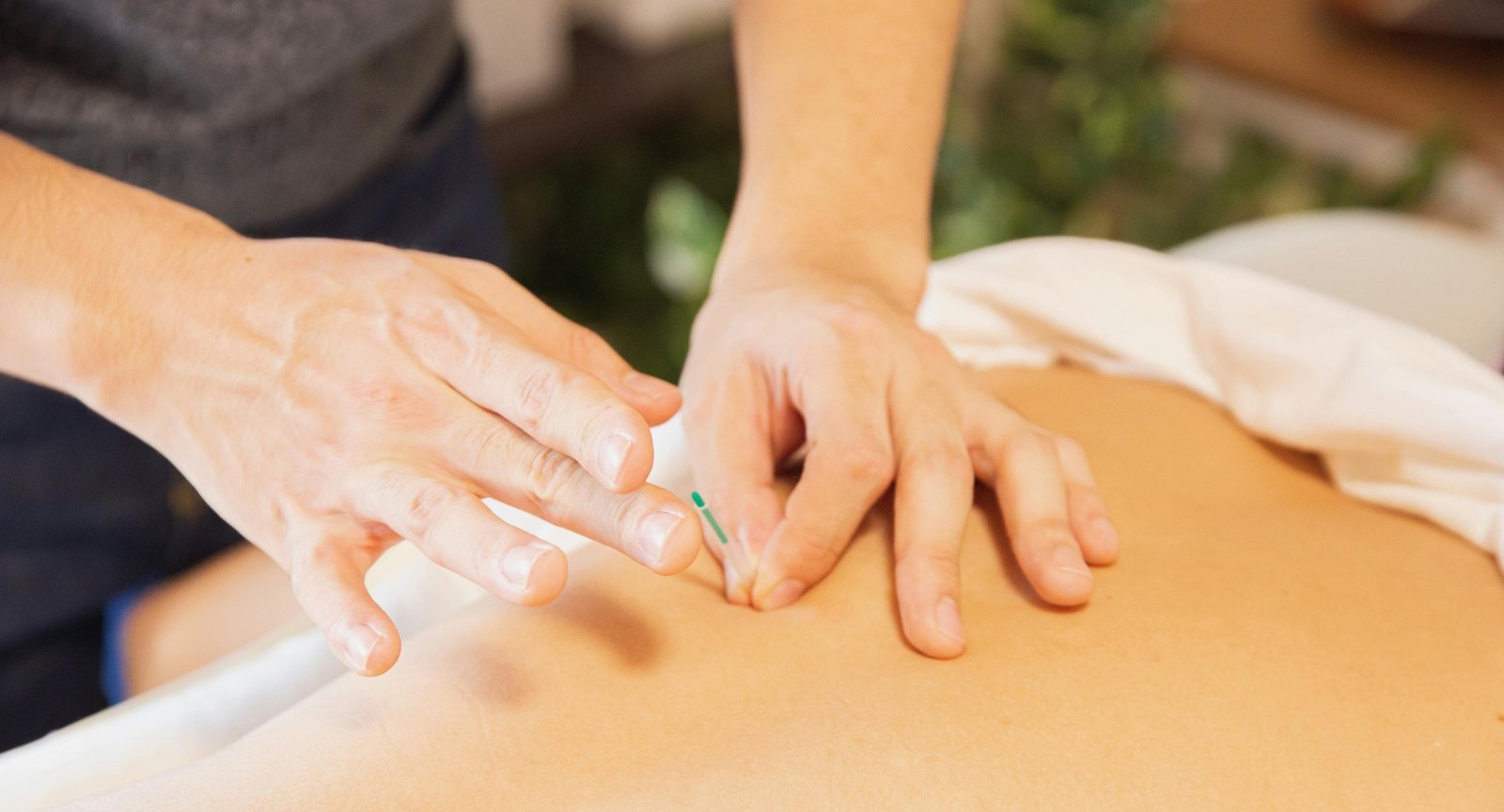 tecnicasinvasivas 1 galea