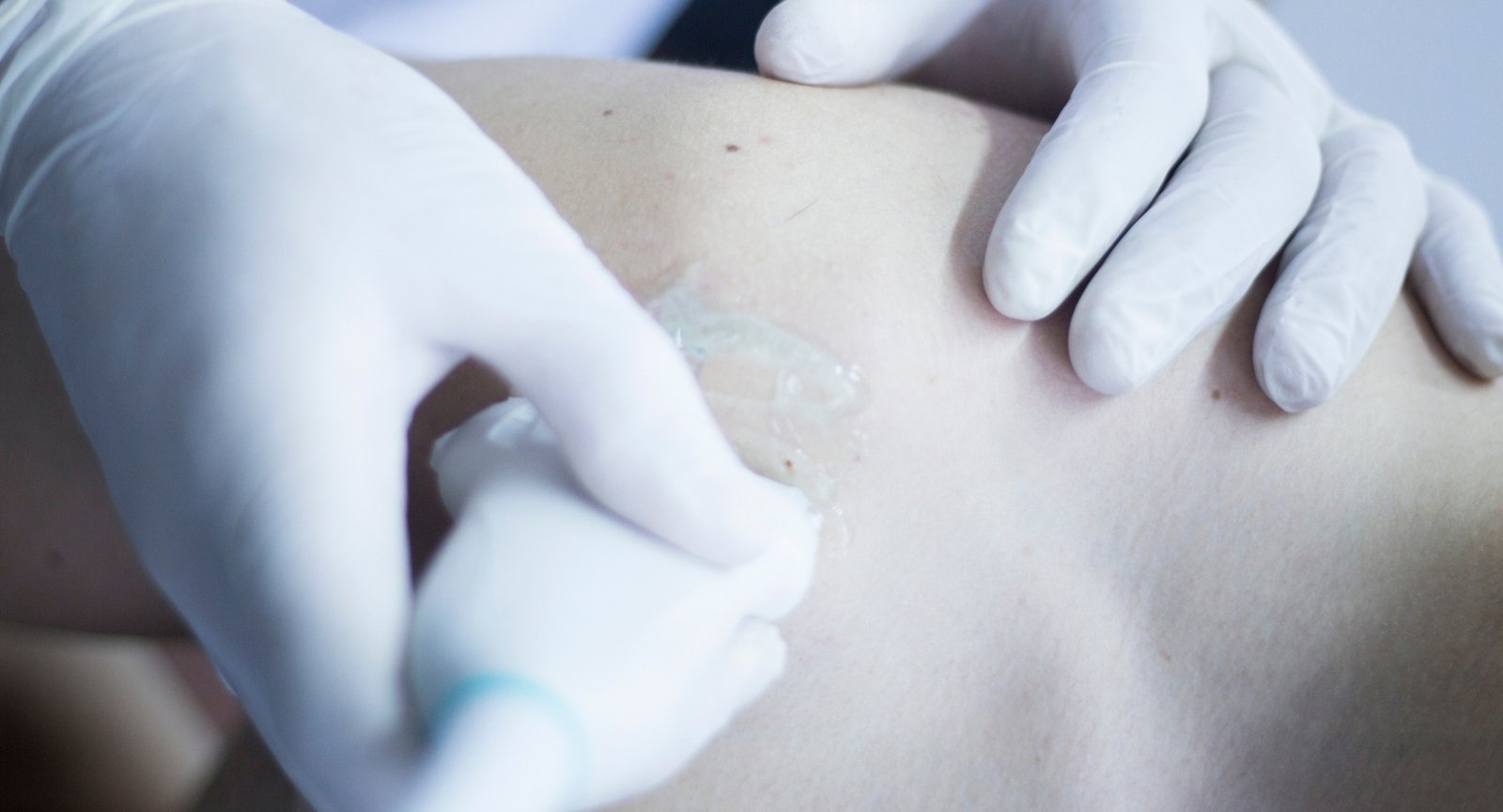 tecnicasinvasivas 3 galea